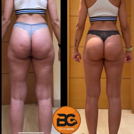 foto de atleta antes e depois de passar pelo programa de transformação corporal